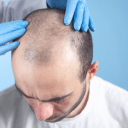 doctor checking patient hair