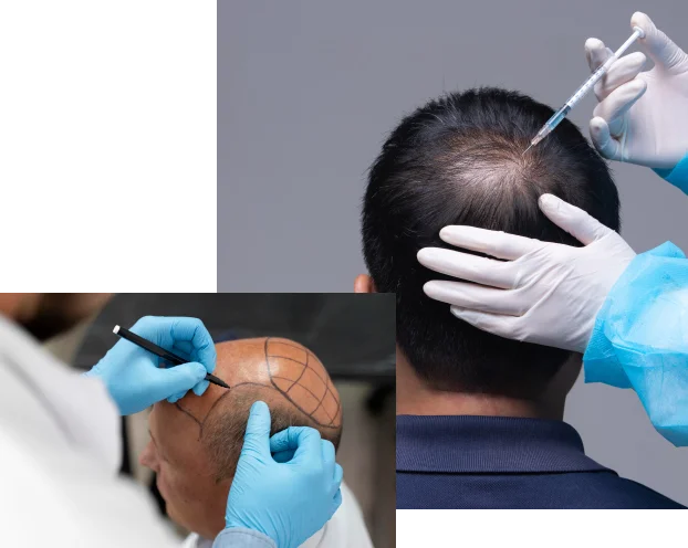 Top-Rated Hair Transplant Clinic